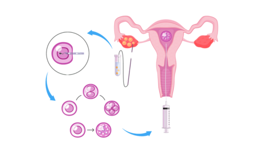 IVF Services